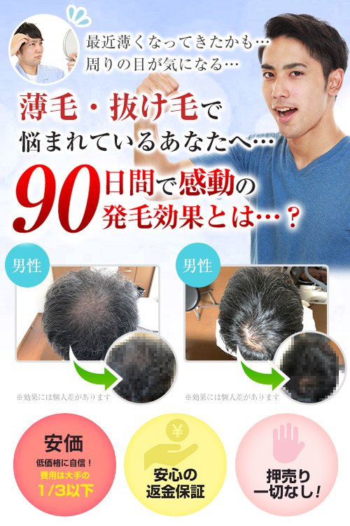 薄毛・抜け毛で悩まれているあなたへ…90日間で感動の発毛効果とは…？