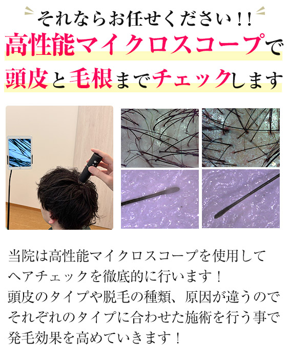 マイクロスコープ