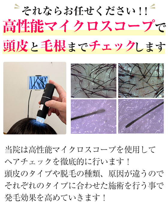 マイクロスコープ